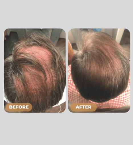 Root Activator Shampoo - Noyré