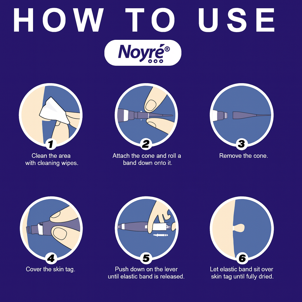 Noyré Tagbud - Noyré