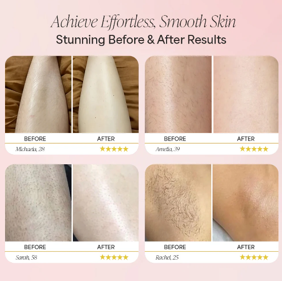 Beach Party Trimmer 2.0 - Noyré