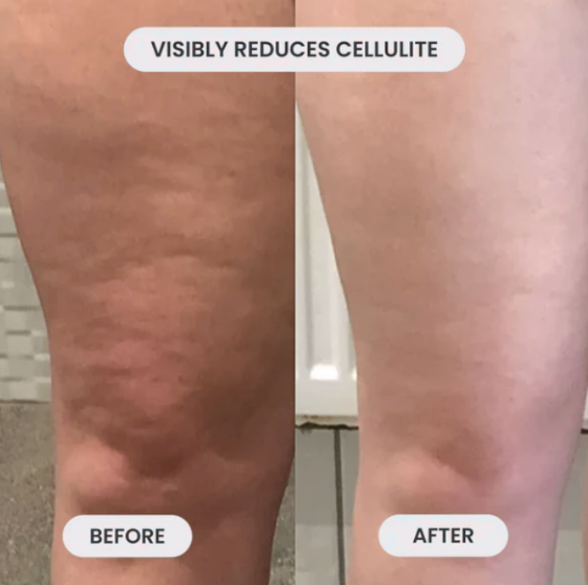 CelluFade Pro - Noyré