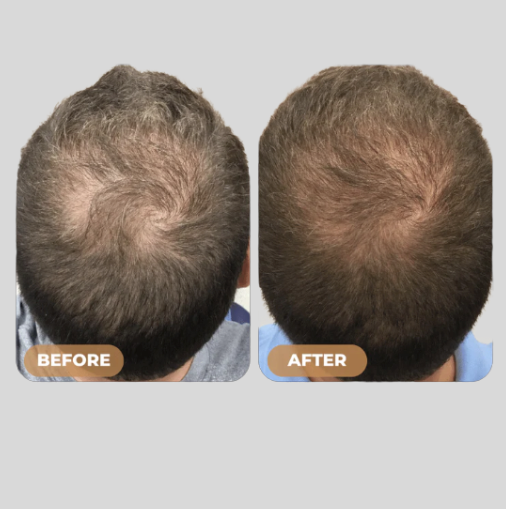 Root Activator Shampoo - Noyré