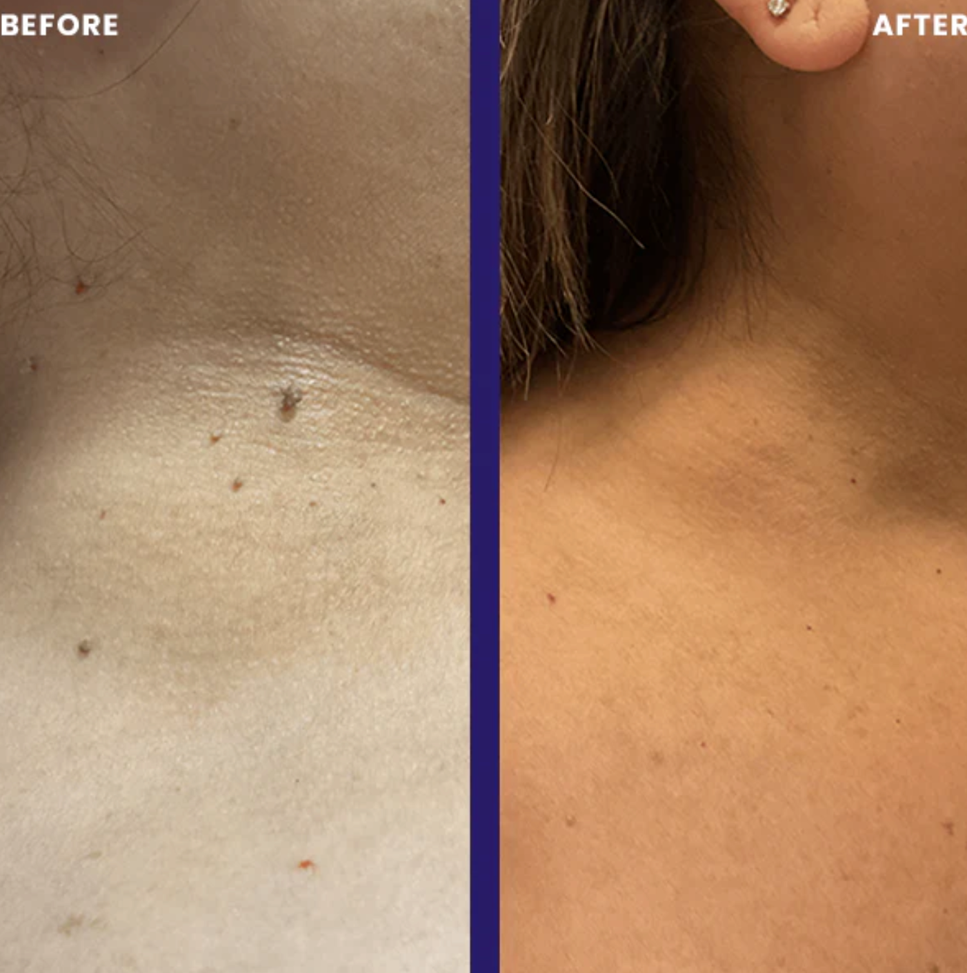 Noyré Tagbud - Noyré