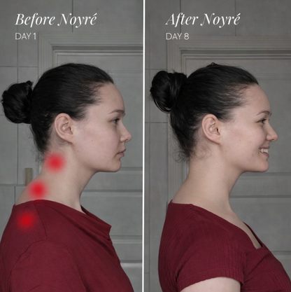 Noyre NeckRelief